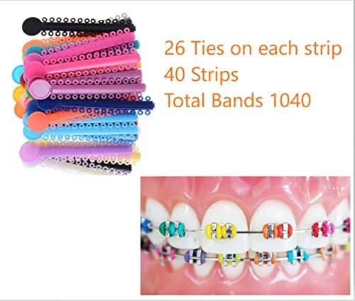 Уметнички загради во боја, разнобојни стоматолошки ортодонтски врски со лигатура 1040 компјутери лесни за промена на врските во боја