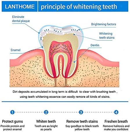 Орев зуи заби бела, лантоме заби за белење на заби, отстранувач на дамки од заби до белење на забите, белило за белеење на заби за заби, заби за отстранување на дамки ?