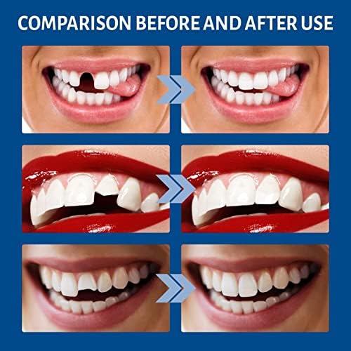 MLLKCAO привремени комплети за поправка на забите заби и празнини Фалсетие цврсто лепак лепило за полнење заби заби лажни дупки за полнење скршени заби, ве прават поуб