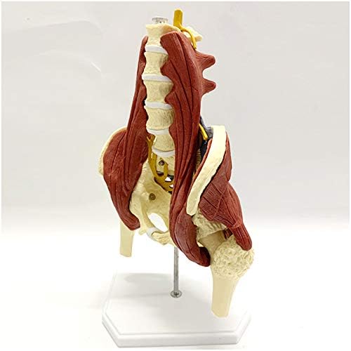 KH66ZKY Lumbar Spine Model Model Model Moders Muscle Muscle со коски на карлицата, хернијација на нервни диск, за образование