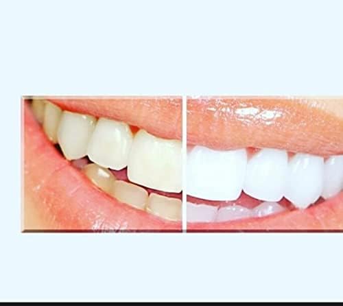 Изрази комплет за белење на заби за заби