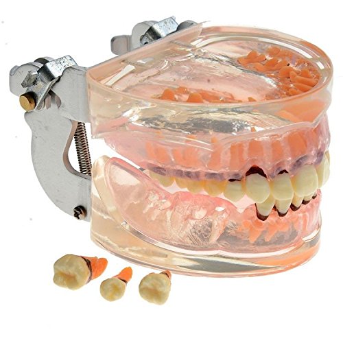 Doc.Royal Dental Sudy Транспарентна патолошка патодонтална болест на возрасни модел на заби 4017