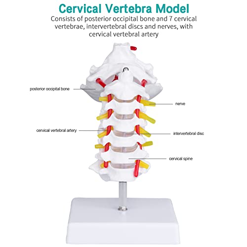 Модел на матки на цервикална матка - модел на цервикален 'рбет со заден окципитален коски на цервикалниот првенство на првенки на артерии Артерии