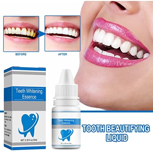 Суштината на избелување на забите, интензивно отстранување на дамки за заби за белење на забите, суштината на белење на забите за чувствителни