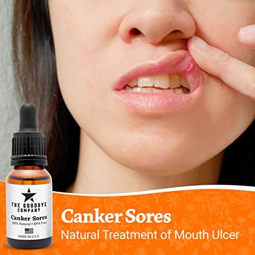 Третман на рани од рак - корисен за третман на чир на устата, ефикасен серум на есенцијално масло за олеснување
