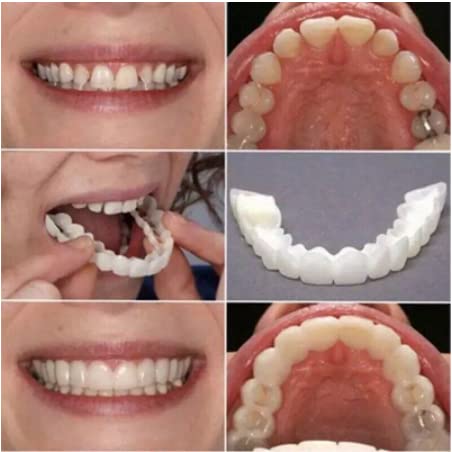 Cxstarlicu 1 компјутери козметички лажни заби, заби за заби, приклучок за протези за привремена, природа и удобно, заштитете ги забите